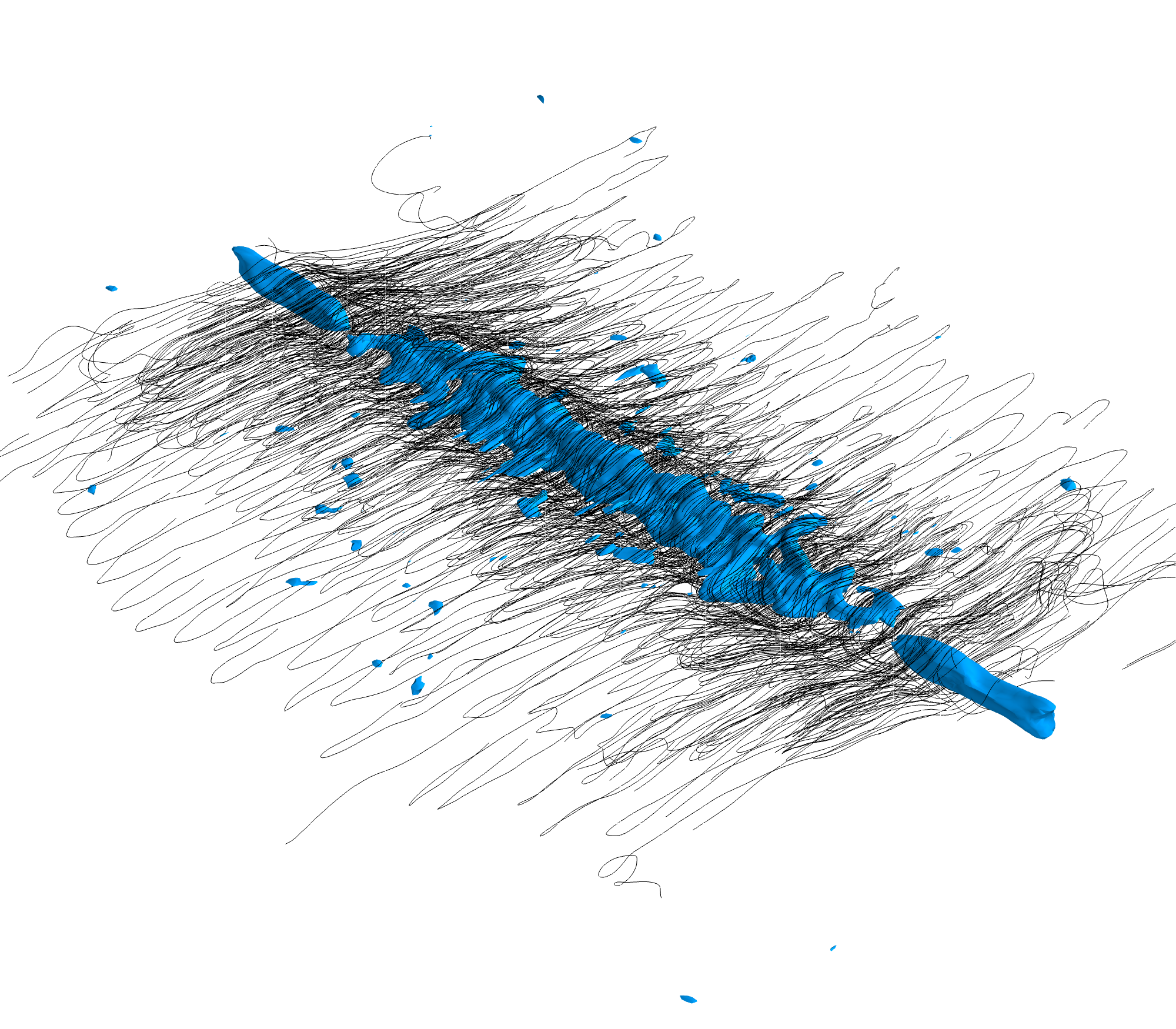 CMR streamlines